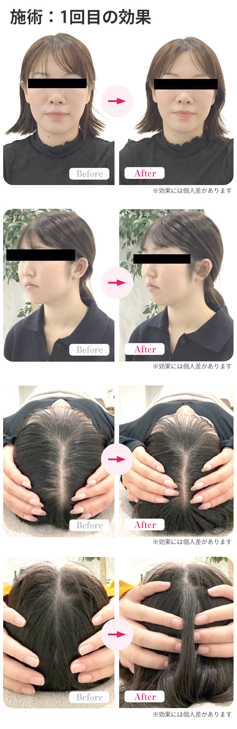 ビフォーアフター