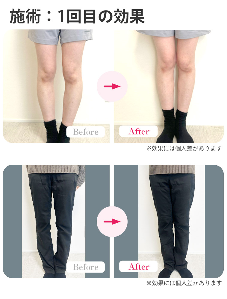 ビフォーアフター