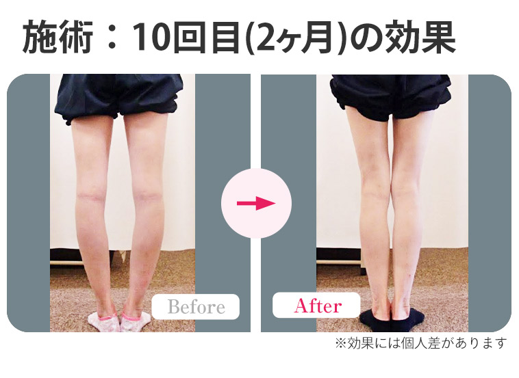 ビフォーアフター